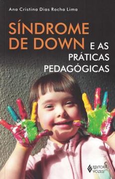 Imagem de SINDROME DE DOWN E AS PRATICAS PEDAGOGICAS