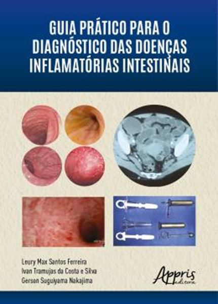 Picture of GUIA PRATICO PARA O DIAGNOSTICO DAS DOENCAS INFLAMATORIAS INTESTINAIS